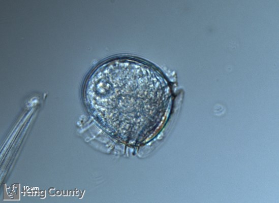 Photo of Dinophysis rotundata